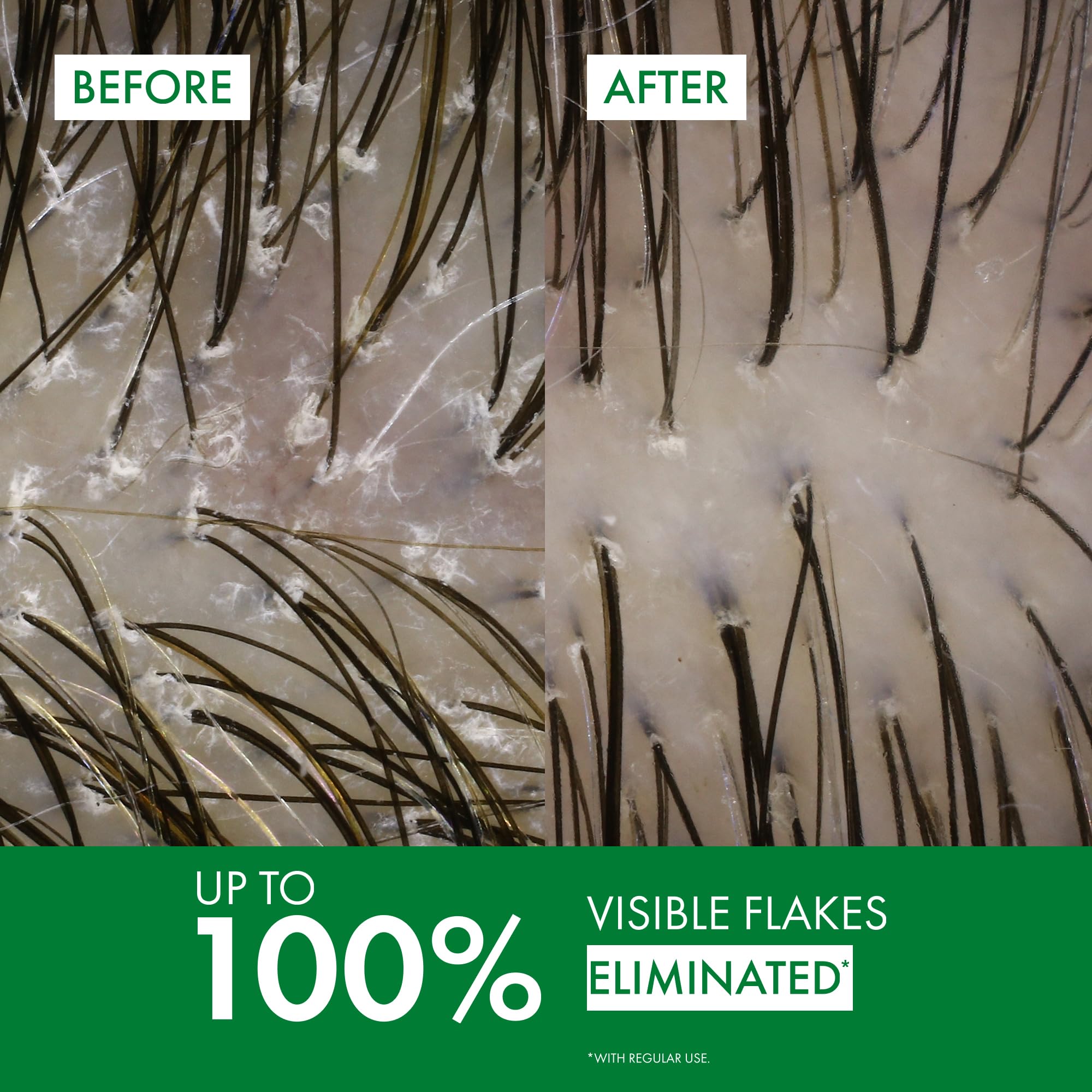 Vichy Dercos Medicated Anti-Dandruff Shampoo with Selenium Sulfide