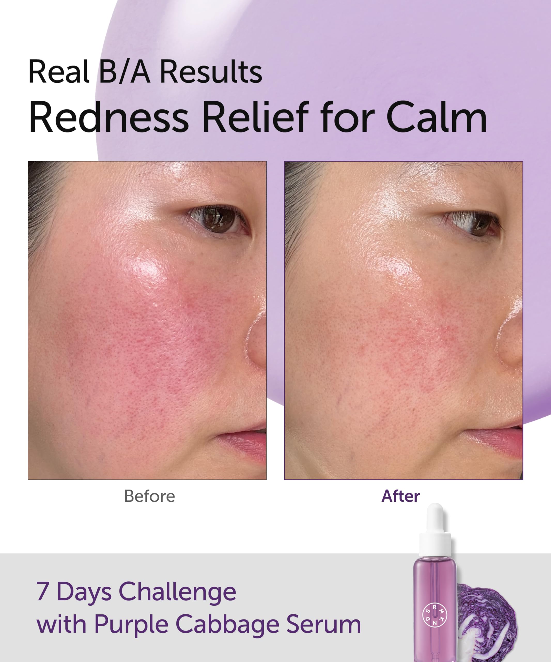 SERUMKIND Purple Cabbage Serum, Calming and Skin Recovery- Korean Face Skincare, Beta Glucan 100,000ppm - Image 3