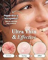 Vista 5 de Parche invisible para espinillas, parches clásicos para el acné hidrocoloide para la cara, parches de acné ultrafinos con mango fácil de despegar