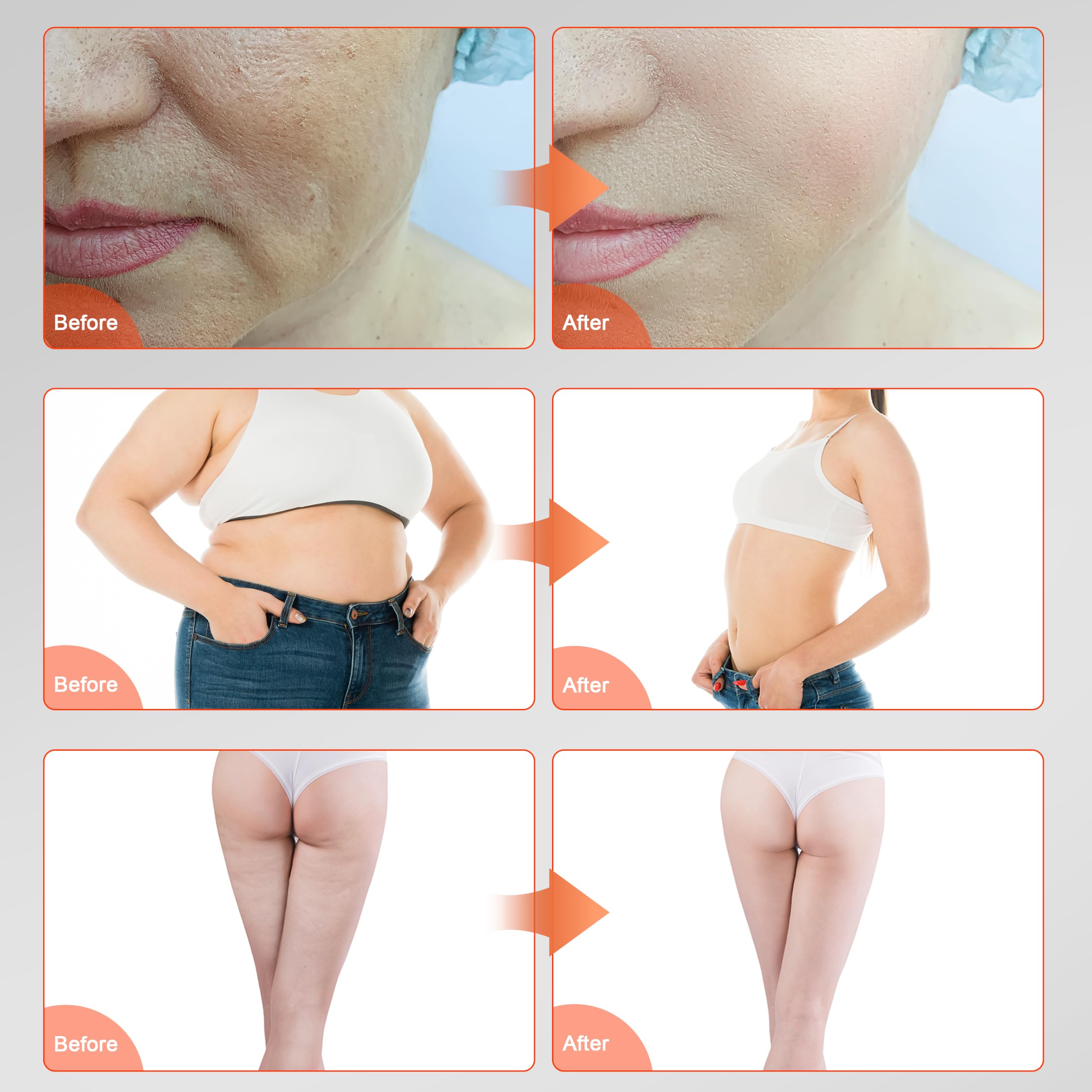 Elitzia 6-in-1 Körperformung, Kavitation, 80 K, Maschine, Fettverbrennung, Vakuum, Radiofrequenz, EMS, Hautstraffung, RF, reduziert Falten, RF, Ultraschall, Kavitationsmaschine, Salon, Spa