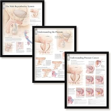 Set of 3 Framed Medical Posters Male Reproductive System Understanding The Prostate and Understanding Prostate Cancer 22"x28" Wall Diagrams