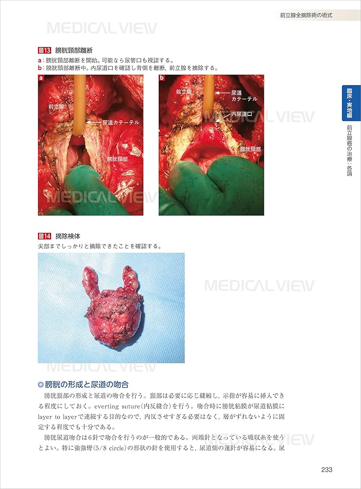 前立腺癌のすべて 基礎から最新治療まで 前立腺癌のすべて−基礎から最新治療まで | 市川 智彦, 鈴木