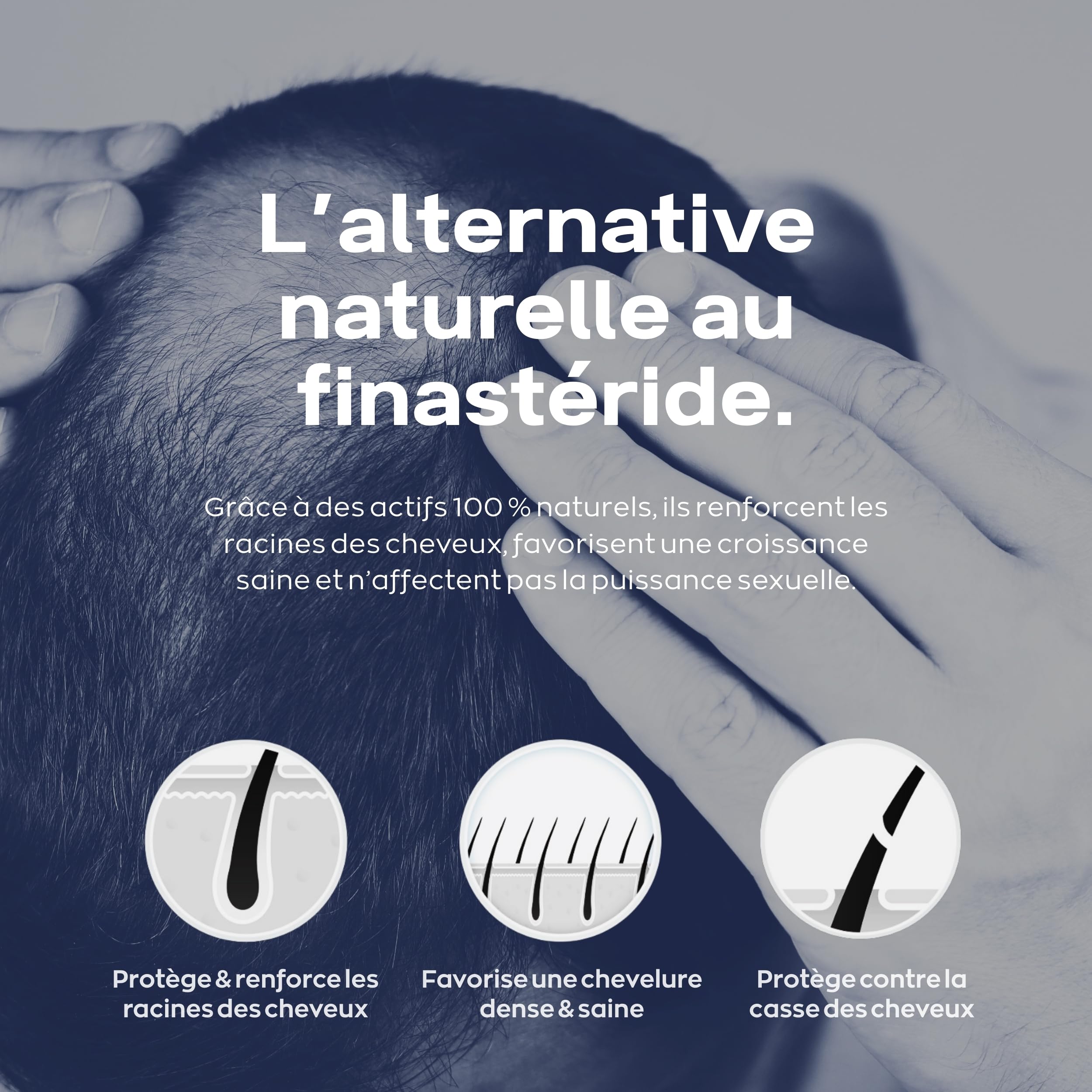 XPECIA Comprimés pour hommes contre la chute des cheveux, bloque la DHT, nouvelle formule de croissance des cheveux 120 Unité (Lot de 2 boites de 60)