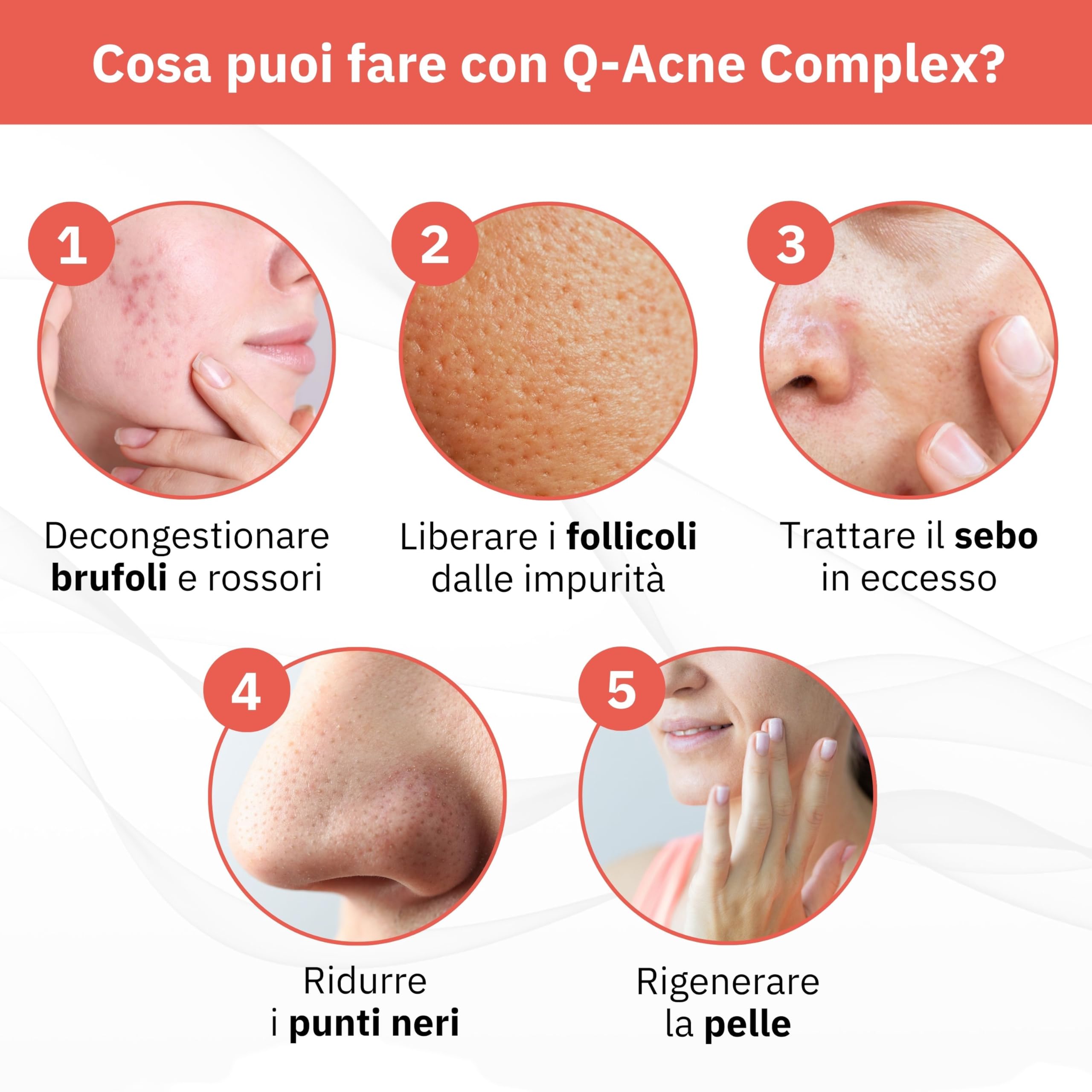 Q1 Q-Acne Complex, Crema Anti Acne con Acido Salicilico, per Viso | Rimuove brufolo e rossore | Trattamento per acne giovanile ed ormonale, 40ml