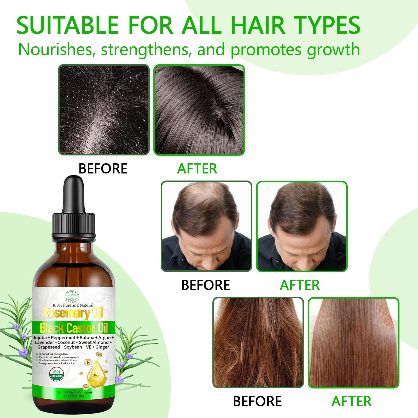 Aceite de romero para el crecimiento del cabello con ricino, mezcla orgánica prensada en frío, aceite natural para el cuero cabelludo, alivia la picazón del cuero cabelludo, repara el cabello seco y 3