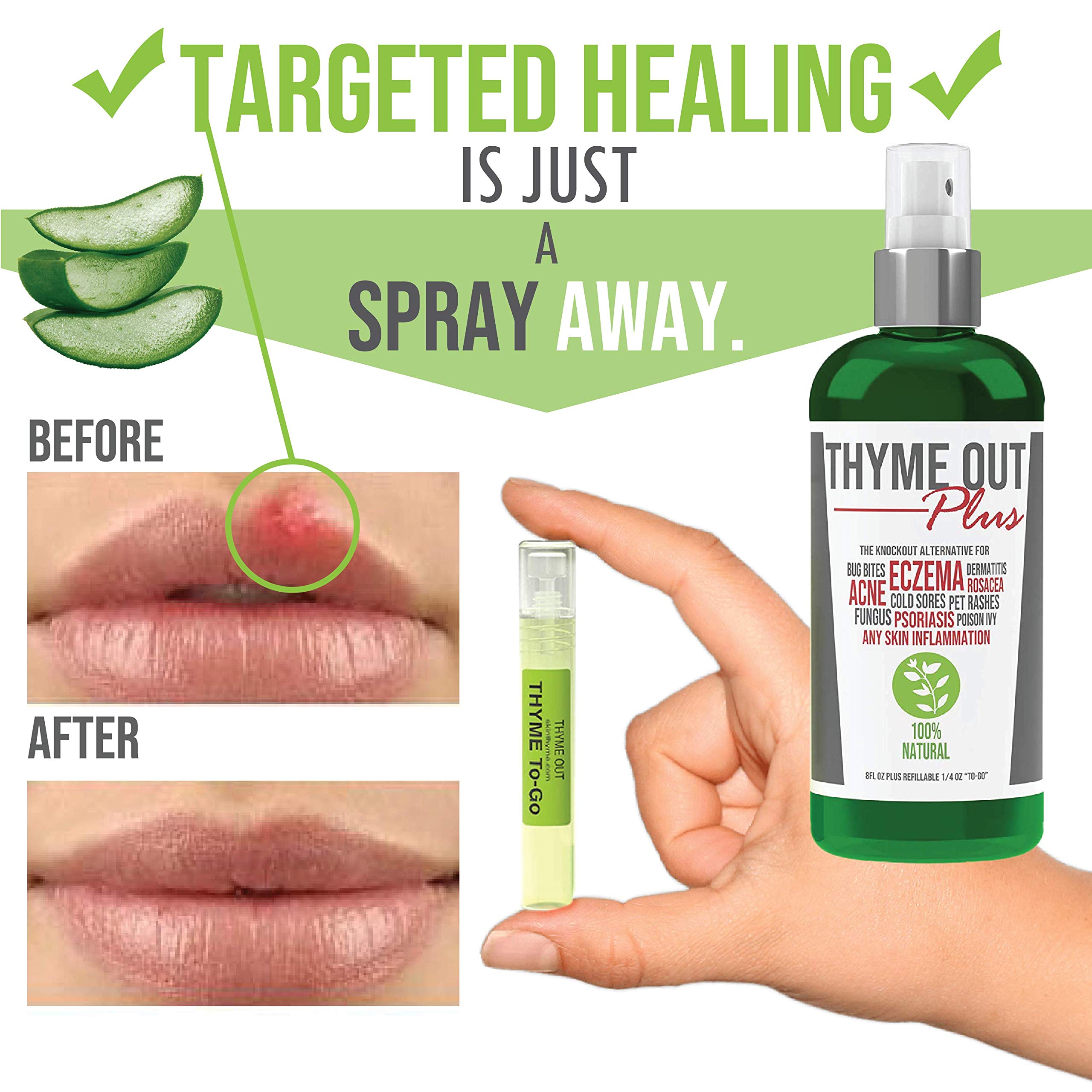 Thyme Out Plus Eczema Treatment, Psoriasis Treatment Treats Acne