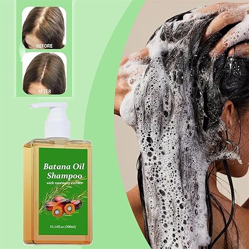 Miniatura 2 de Champú de aceite de batana - Champú de Batana para la Caida del Cabello, aceite de batana para la caida del cabello, aceite de batana y champú de