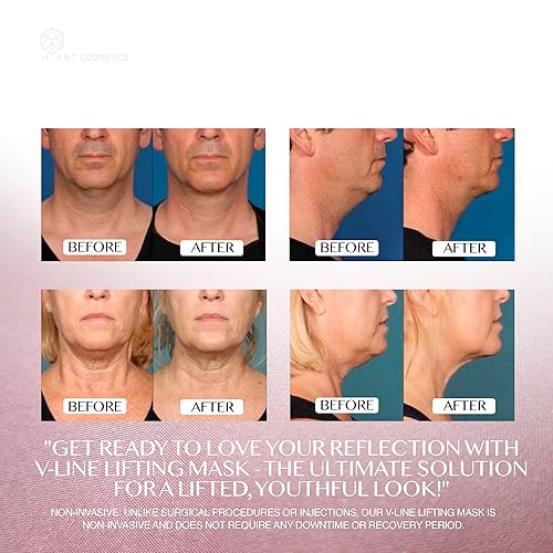Miniatura 4 de Máscara de elevación de línea V con antienvejecimiento como se ve en la televisión, reductor de barbilla doble, máscara facial adelgazante en forma