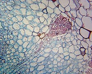 Marchantia Gemmae - Microscope Slide