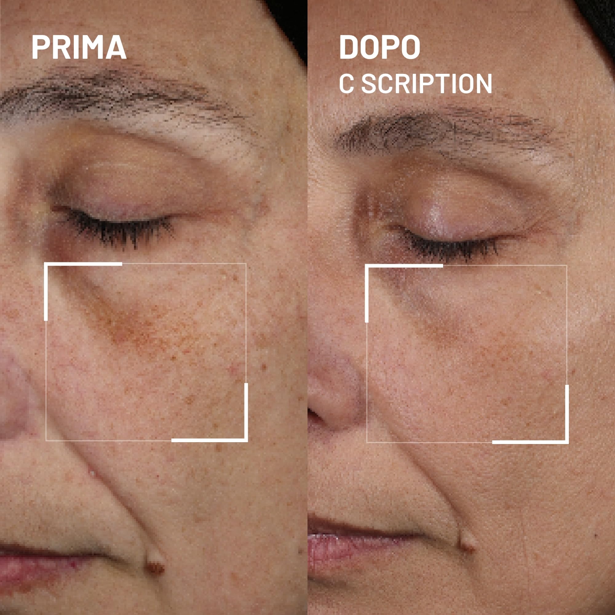 Dr. Brandt Bright This Way C Scription - Siero concentrato alla vitamina C - Attenua le macchie scure, riduce le rughe e illumina il tono della pelle - 30 ml