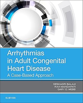 ARRHYTHMIAS IN ADULT CONGENITAL HEART DISEASE (PB 2019)