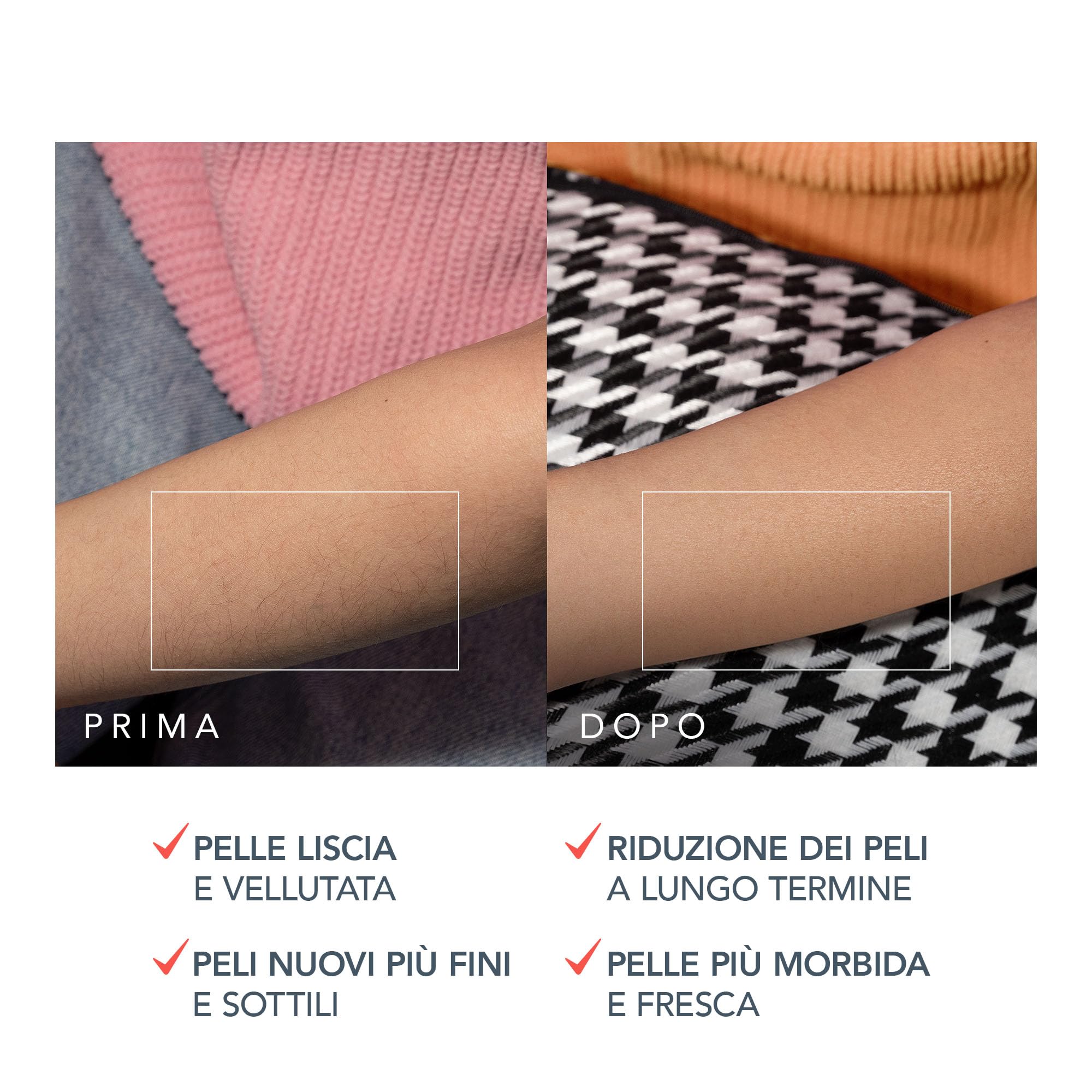 FOREO PEACH 2 Pro Max epilatore luce pulsata, depilatore corpo donna, uomo. Depilazione uomo, donna con epilazione IPL avanzata per viso, corpo. Pelle liscia, risultati duraturi