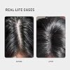 0.5% KINTOR KX-826 Hair Growth Spray,Oil Control Strengthen Hair,Hair Regrowth Products for Women&Men,Basic,60ml