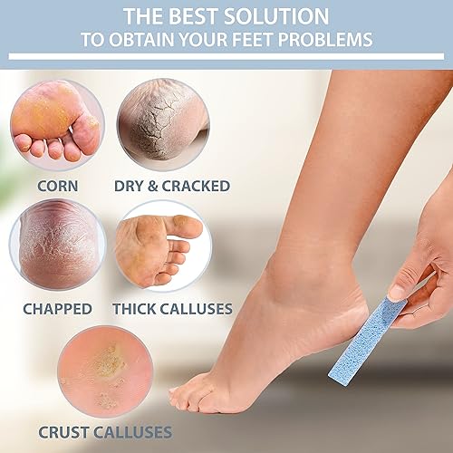 Miniatura 2 de Piedra pómez para pies  Paquete de 3 unidades de removedor de piel muerta  Piedra pómez de vidrio hecho en España para piel dura y removedor de