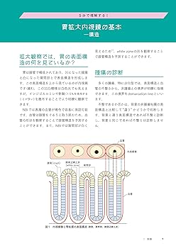 百症例式 胃の拡大内視鏡×病理対比アトラス | 拡大内視鏡×病理