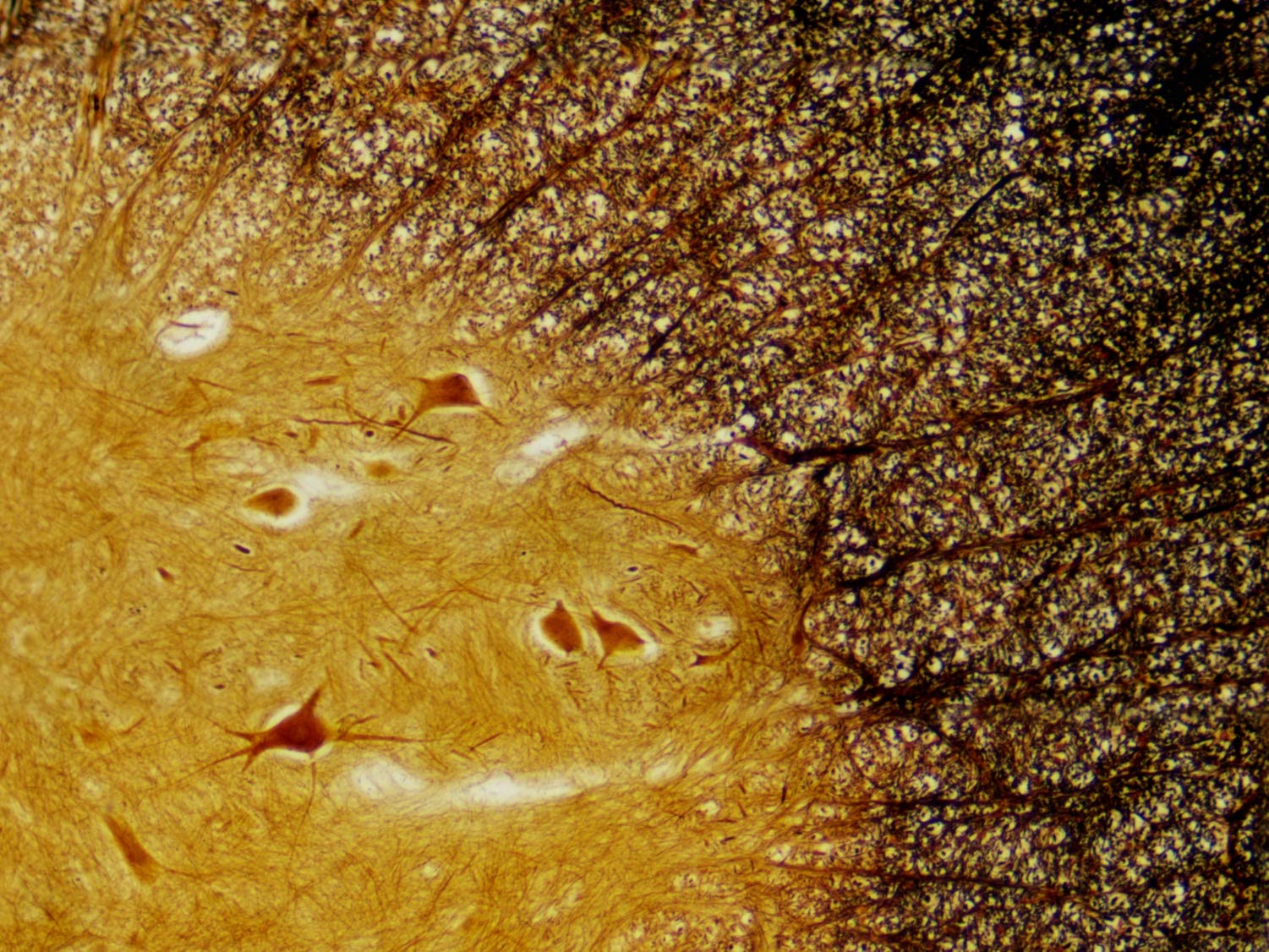 Bresser Muestras Preparadas: Histología