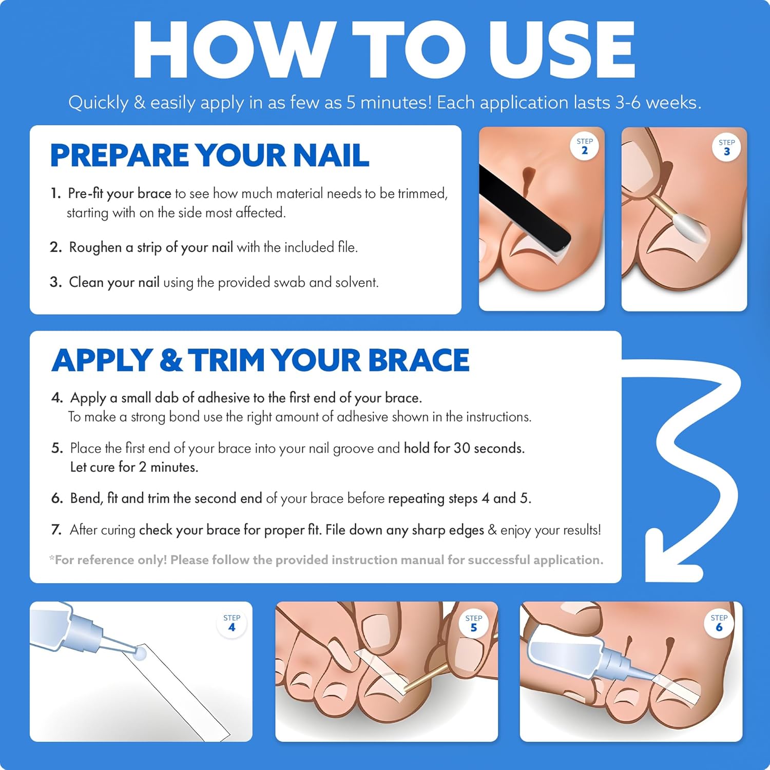 CurveCorrect® Ingrown Toenail Treatment Kit – 10 Clear Braces for Pain Relief & Curved or Curled Toe Correction - At-Home Straightener and Nail Removal Tool