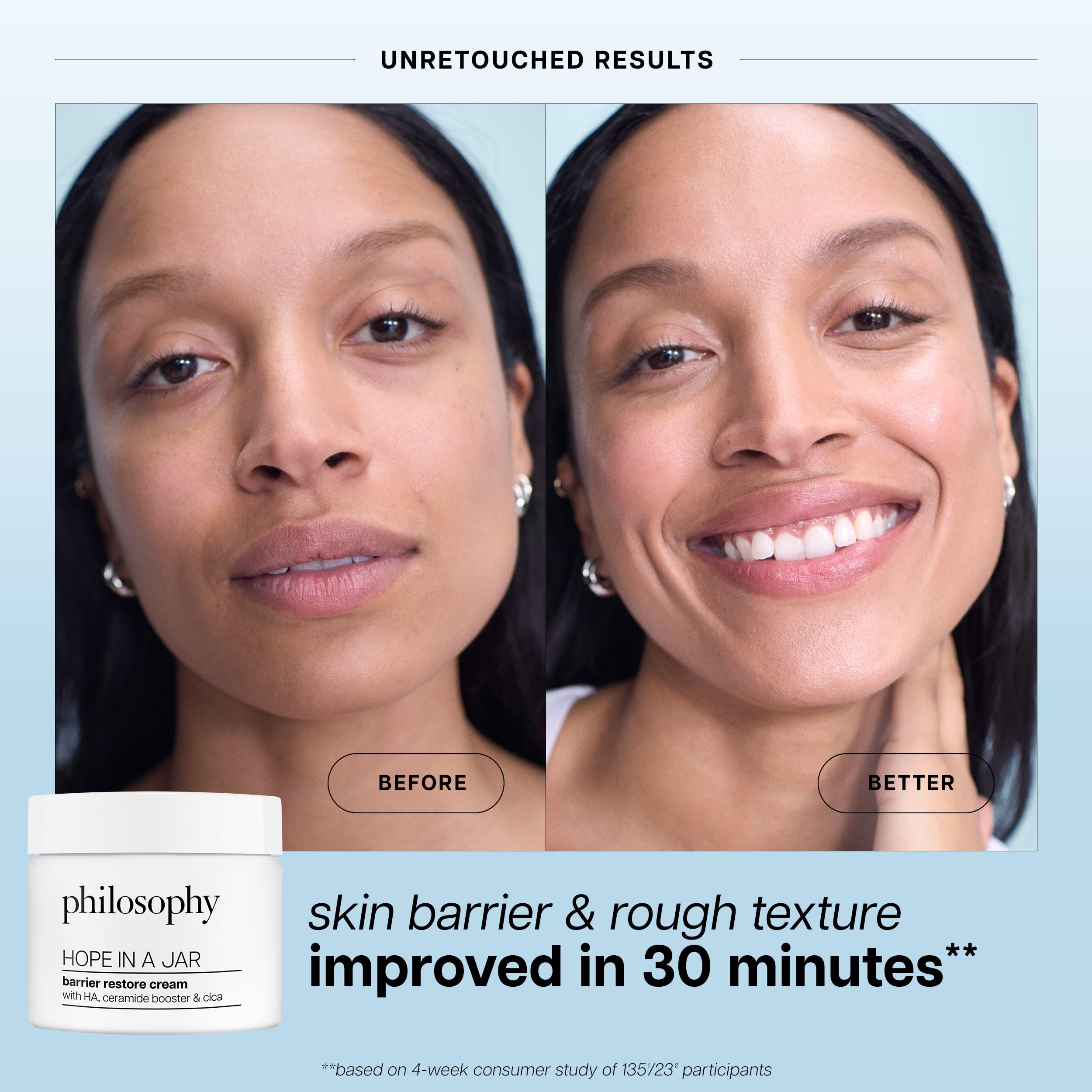 philosophy hope in a jar barrier restore cream – with ha+ complex, cica & ceramides – intensely hydrating moisturizer for dry, sensitive skin – repairs & soothes