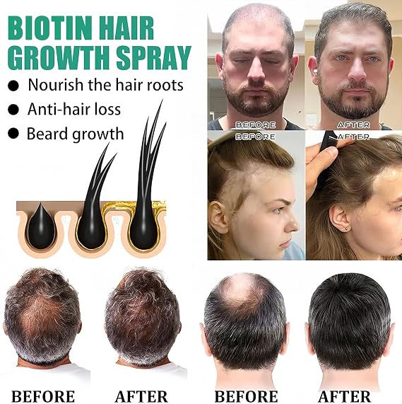 Biotin Hair Serum,Hair Growth Thickening-Hair Loss Treatments for Women Men,for All Hair Types (2pcs)