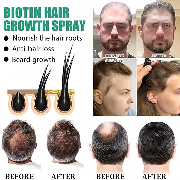 Biotin Hair Serum,Hair Growth Thickening-Hair Loss Treatments for Women Men,for All Hair Types (2pcs)