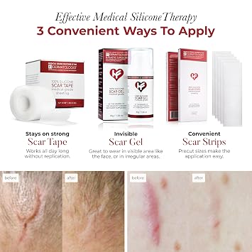 HealFast Scar Suite Bundle Physician-Formulated Silicone Scar Gel + Medical-Grade Scar Sheets + Scar Tape Advanced Scar Treatment for Surgery, Burns, and Injuries Professional-Grade Results