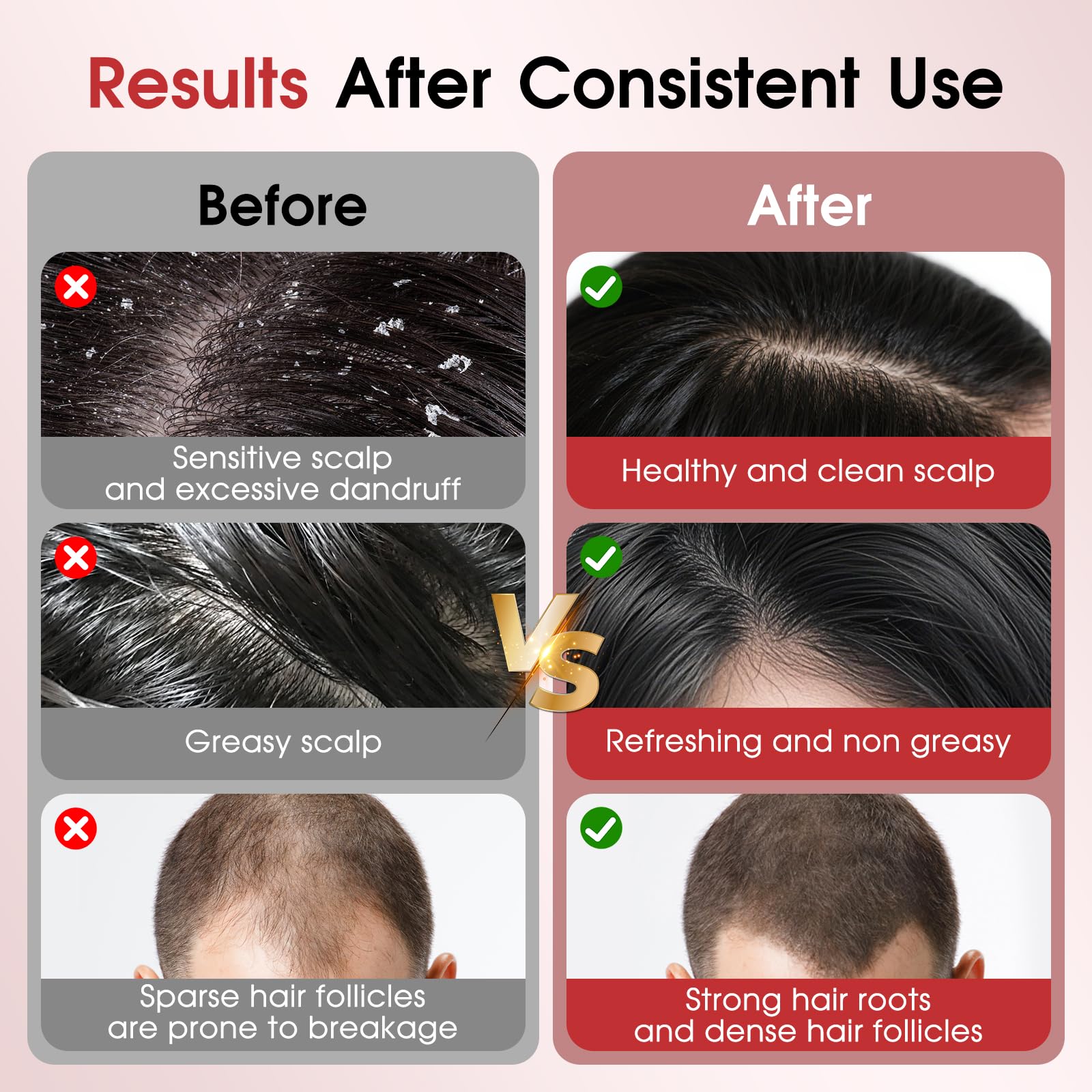 Upgrade Laser Therapy Hair Growth Comb, Hair Oil Applicator and Red Light Hair Brush,Electric Scalp Massager Hair Growth with IPX7 Waterproof