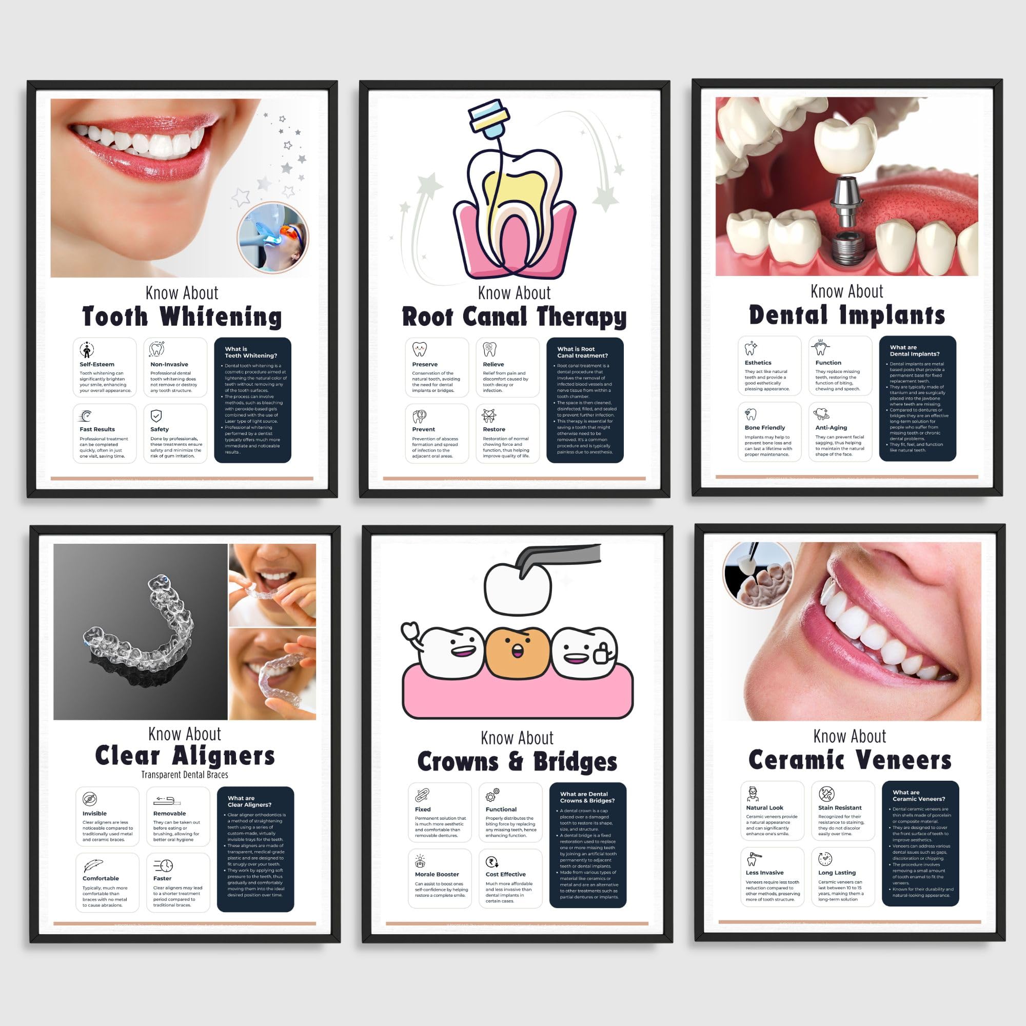 Five Rookie star smile makeover Mistakes You Can Fix Today If You Do Not star smile makeover Now, You Will Hate Yourself Later