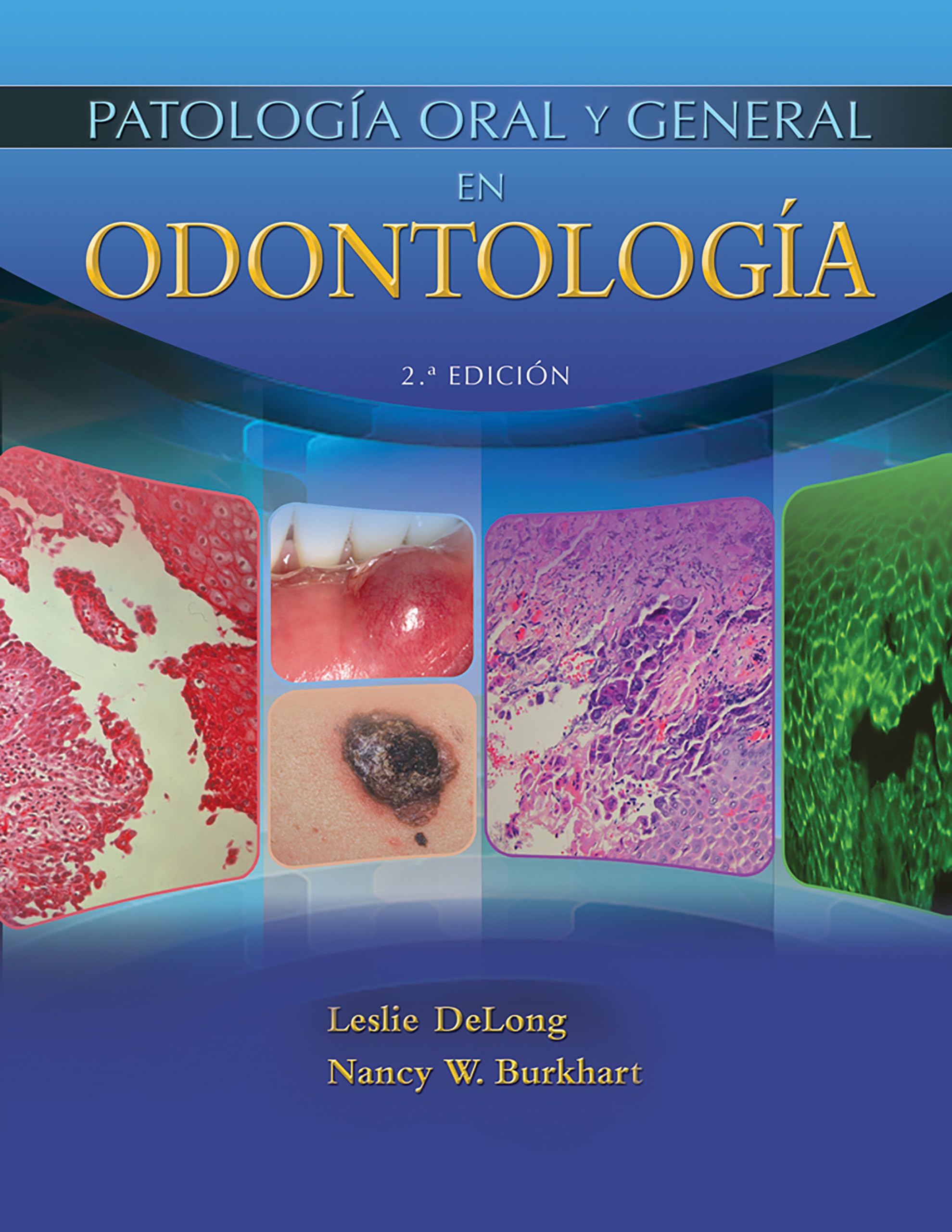General and Oral Pathology for the Dental Hygienist, Enhanced Edition (Spanish Edition)