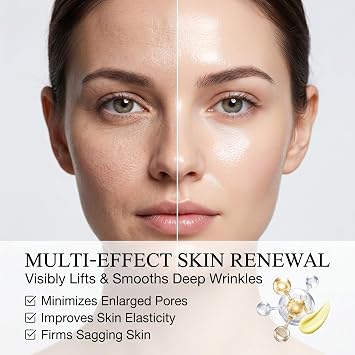 Botoxmix & Vita-A Retinol Shot Wrinkle-Lift Tightening Cream, Anti-Aging Firming Booster, Reduce Wrinkles Fine Lines & Minimize Pores, Korean Skincare For All Skin Types, 1 Pack