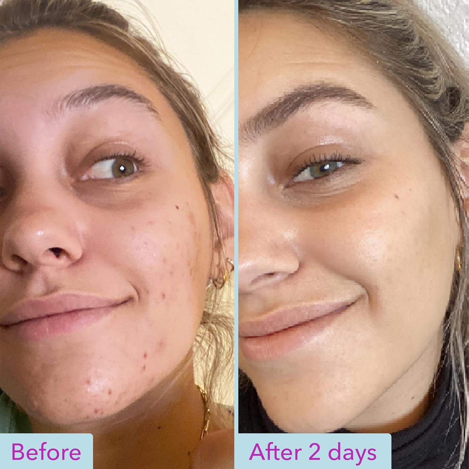 Good Molecules Niacinamide Brightening Toner - Toner for Face with Niacinamide and Arbutin for Skin Tone Balancing- Pore Minimizer, Facial Skin Care - Image 6