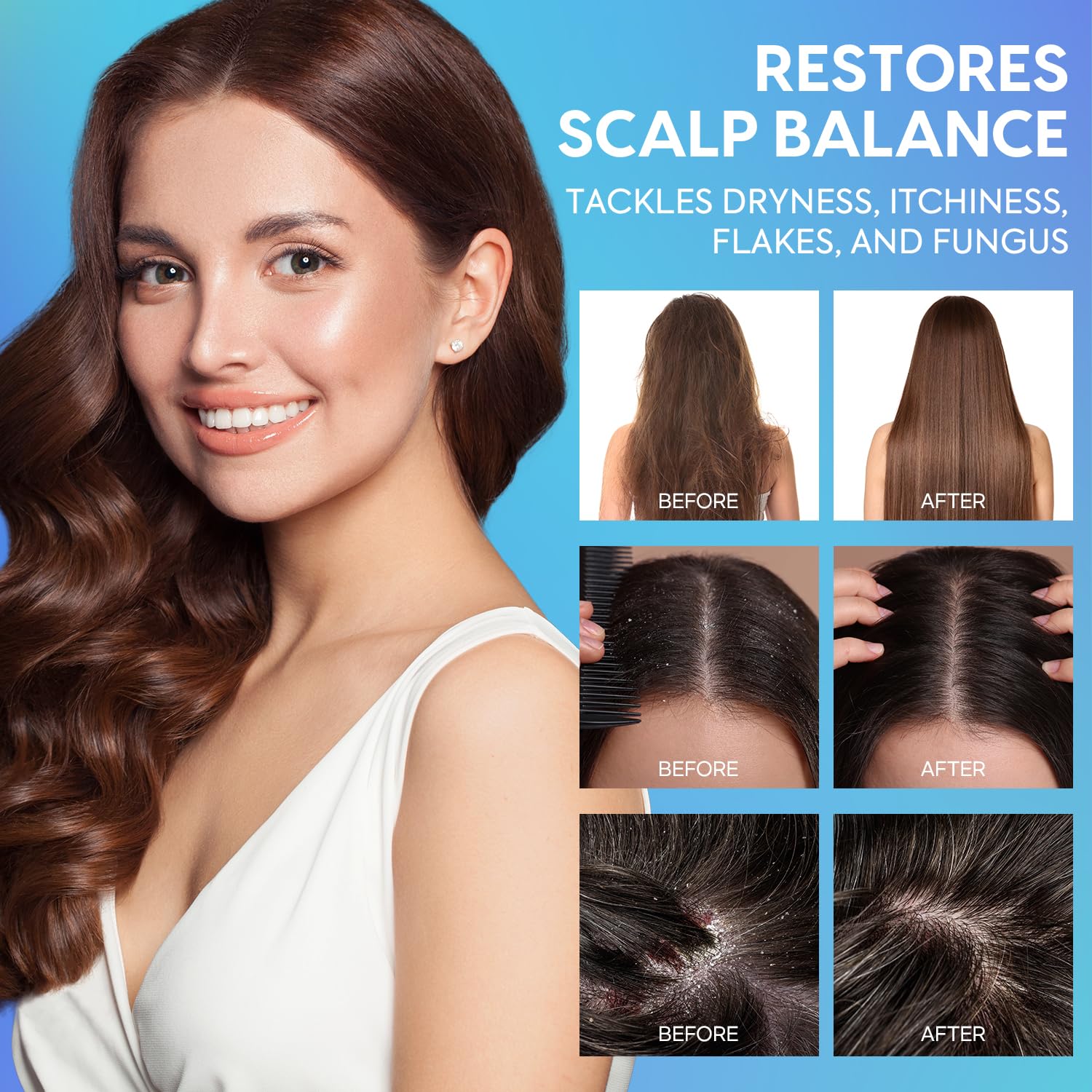 Dandruff Hair & Dry Scalp Conditioner: Deep Moisturizing & Soothing Relief with Natural Ingredients - Calms Itch Fungus Flakes, 10 fl. oz.