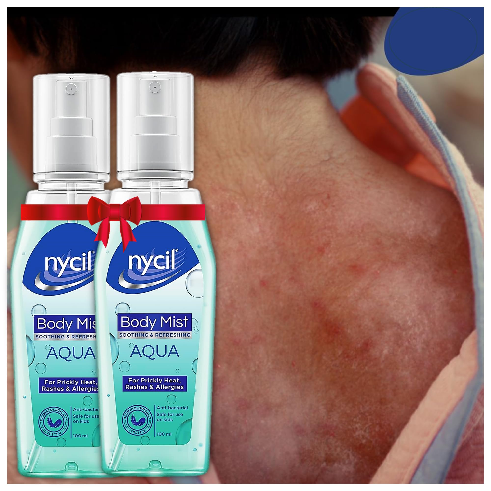 Nycil Soothing Body Mist Aqua Get Relief From Prickly Heat