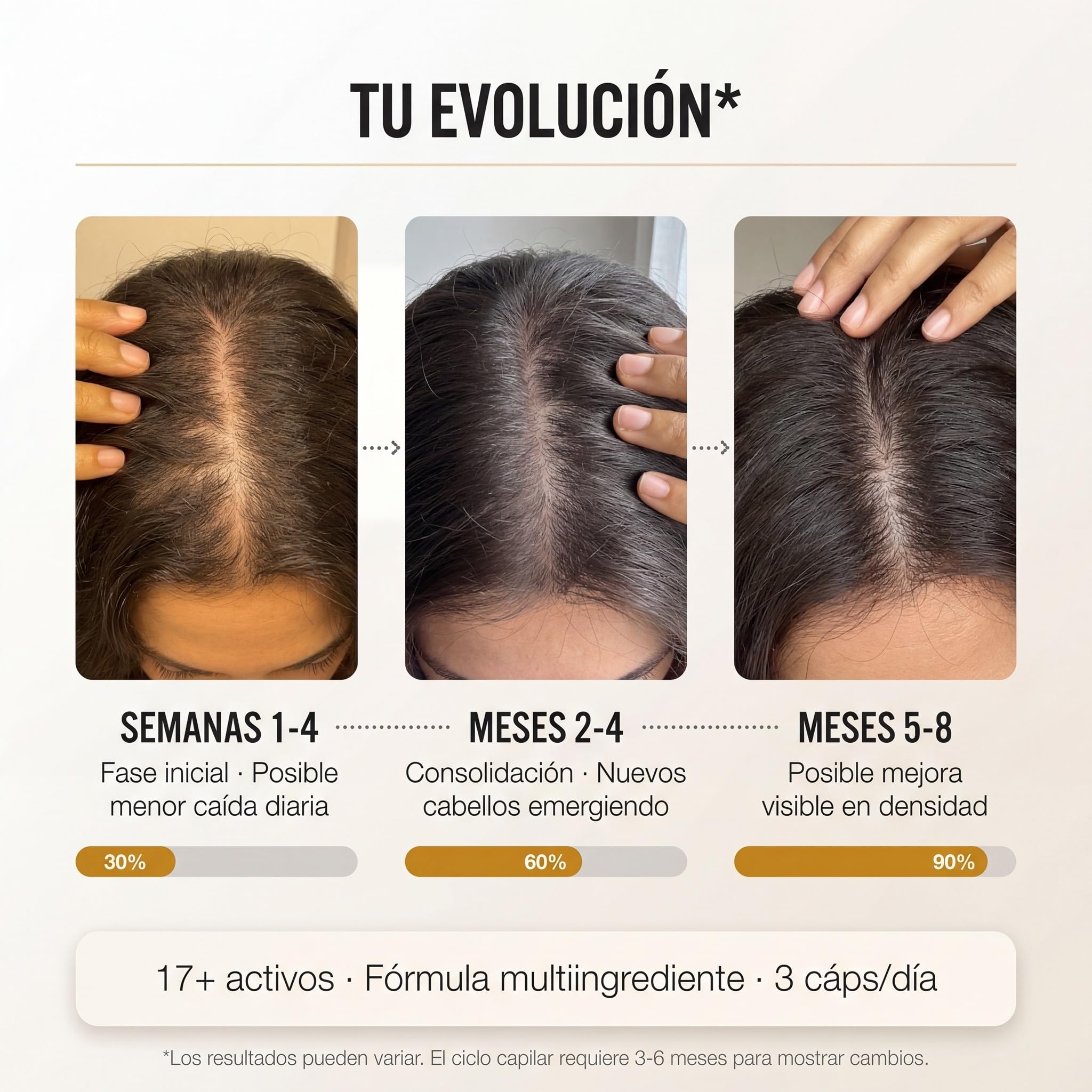 afrodite MELENA | Nutrición Capilar con Serenoa y Ashwagandha | Apoyo para un cabello fuerte | Densidad y Brillo (1 MES 120 Capsulas)