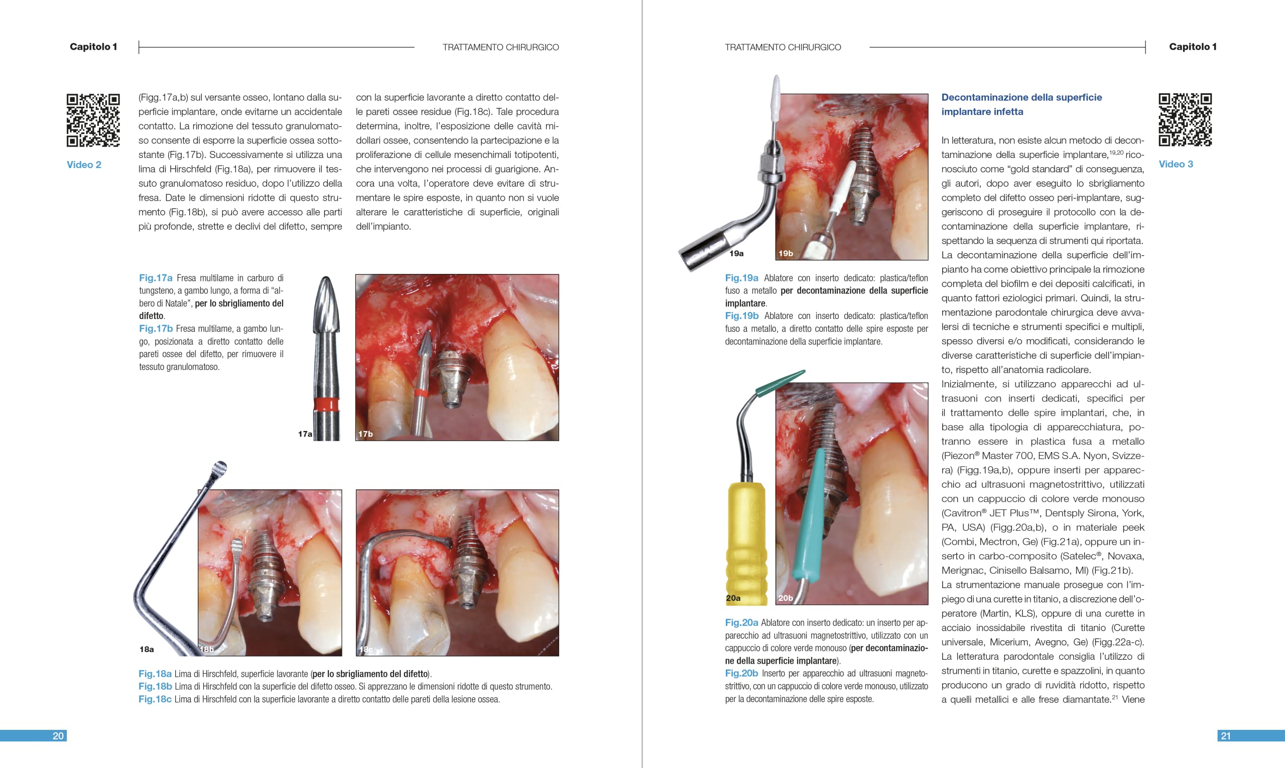 Malattie peri-implantari. Trattamenti chirurgici