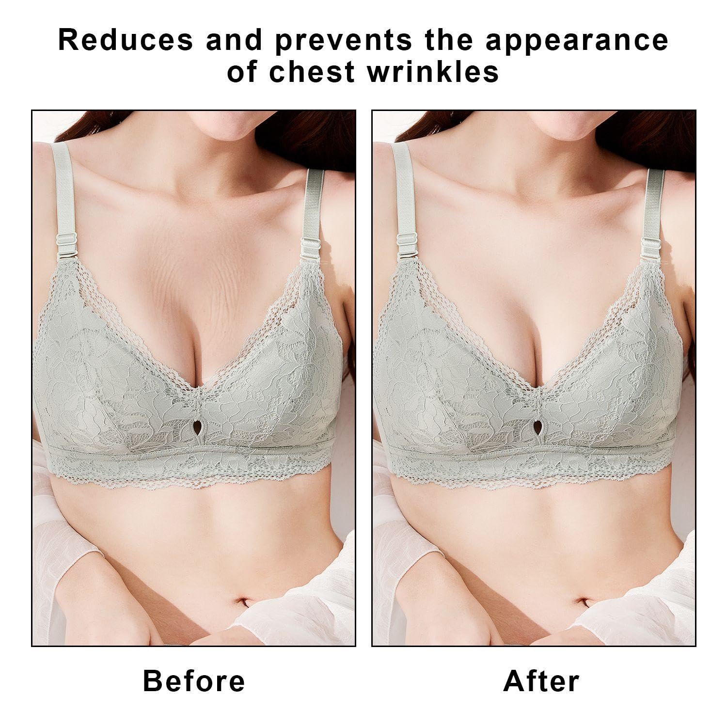 3 Pieces Of Silicone Anti-Wrinkle Stickers, Reusable Anti-Aging Patches, Anti-Aging Patches, Improve Wrinkles And Tighten The Skin - Image 4