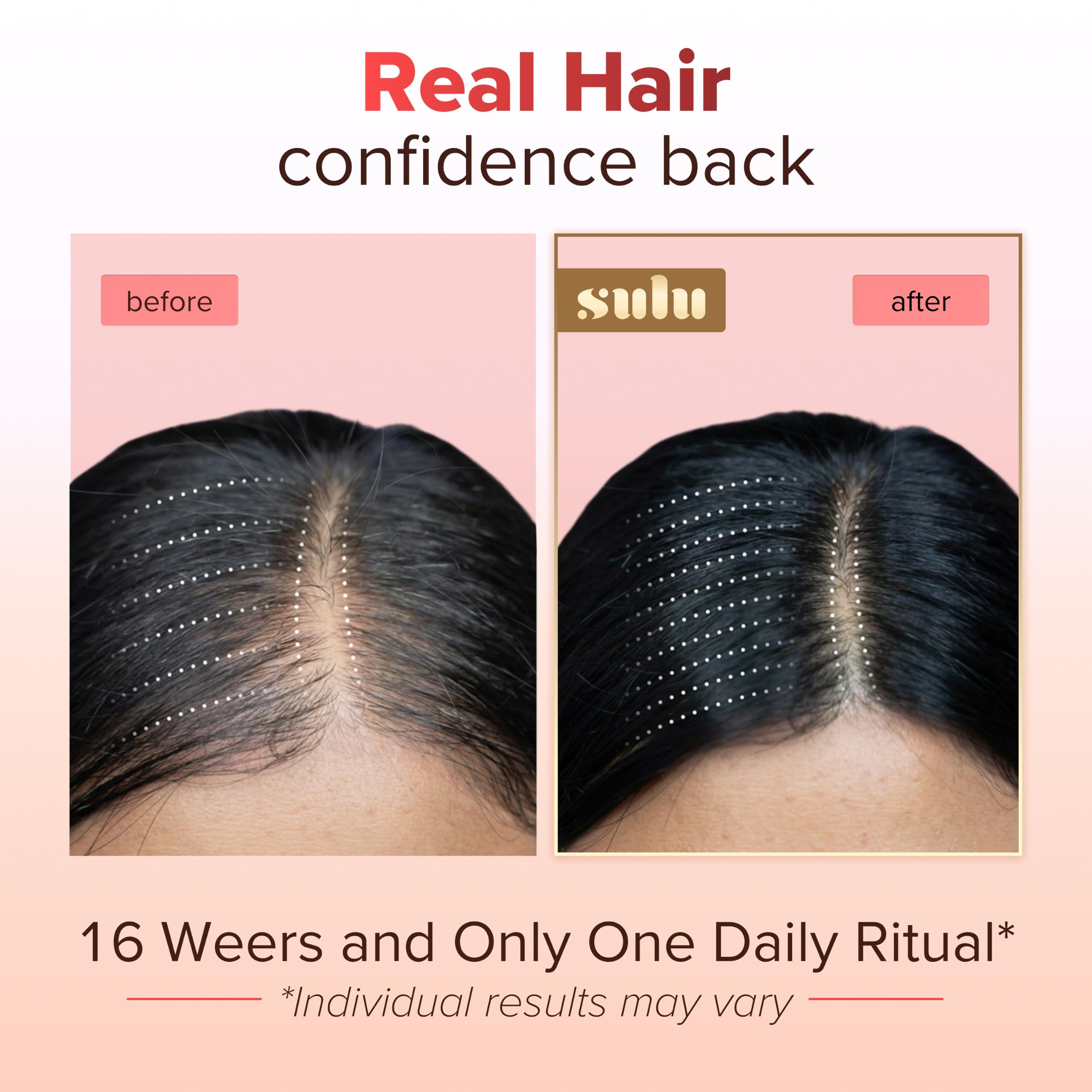 SULU Hair Growth Gummies - Biotin Supplements for Women - Hair Regrowth Skin Nails Vitamins — Amazon image 2