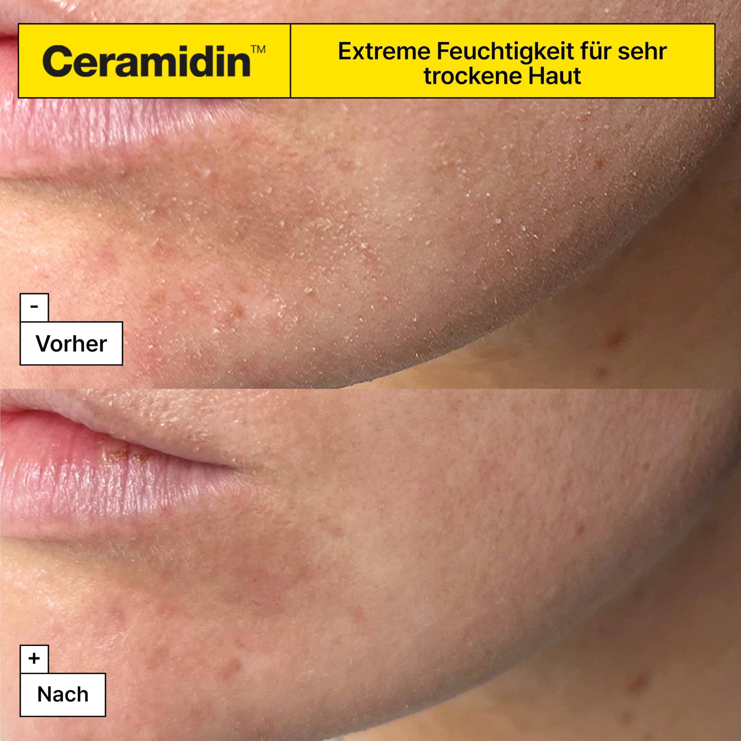 Dr.Jart+ Ceramidin Gesichtscreme 50 ml | Mit Ectoin für trockene Haut | Koreanische Hautpflege