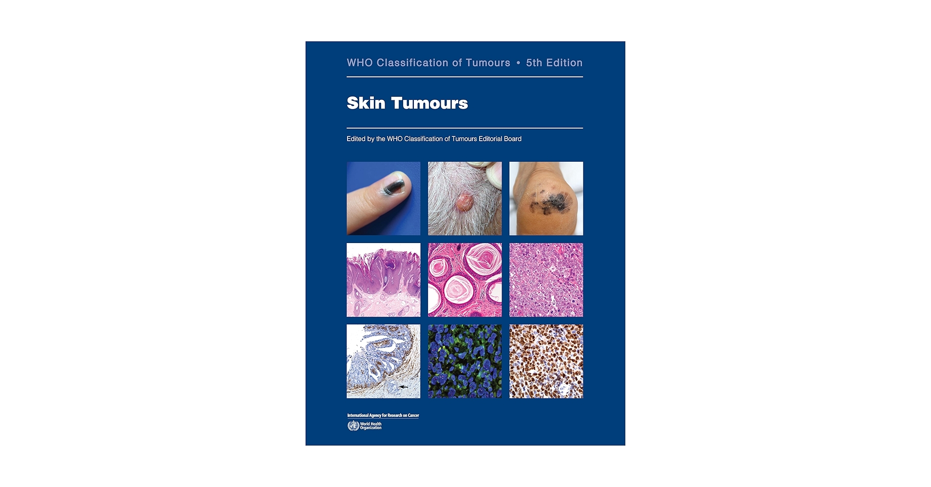 【未開封】WHO Classification of Tumours of En Head and Neck Tumours: WHO Classification of Tumours