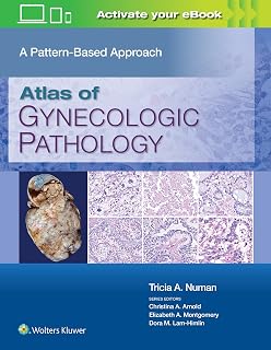 Atlas of Gynecologic Pathology: Pattern-Based Approach by Tricia A. Numan MD - Print + eBook with Multimedia Guide