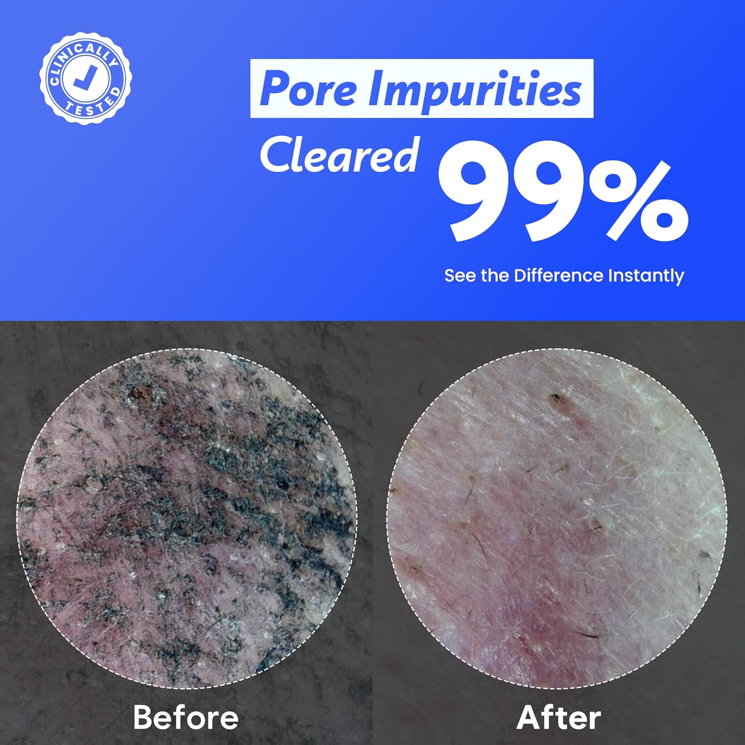 Coconut Jelly Pudding Cleanser | Deep Pore Cleansing & Gentle Exfoliation with Jelly-to-Foam Texture | Hydrating Face Wash with Panthenol, Ceramide & Peptides (100ml) - Image 6