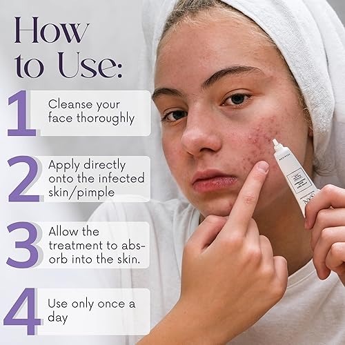 Miniatura 4 de NXN Tratamiento de manchas con probióticos, raíz de regaliz, jengibre y azufre coloidal, para reducir rápidamente el tamaño de las manchas del acné