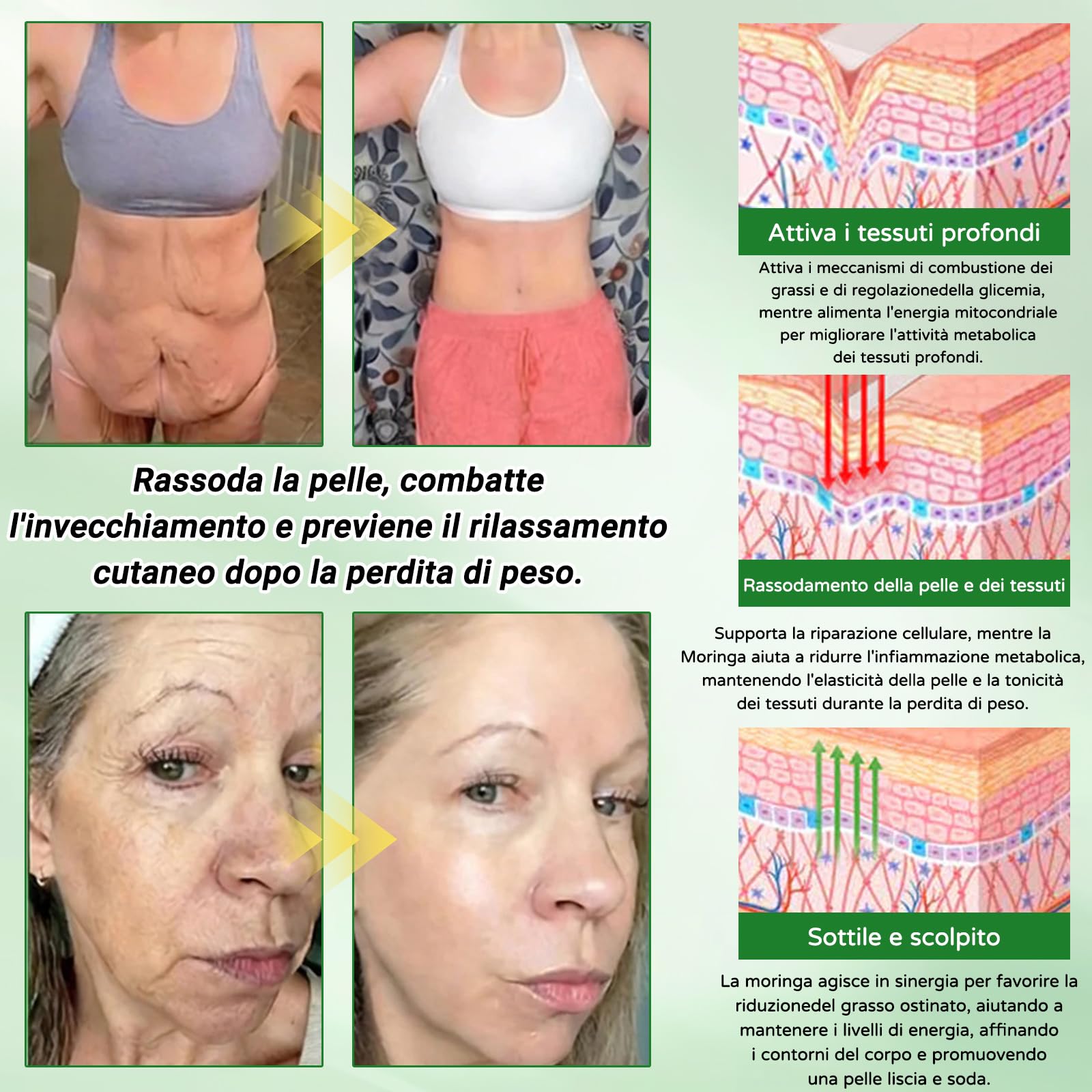 GLORENDA Moringa NAD+ 10-in-1 Cerotto Avanzato Nano Microneedle, Naturali Moringa Cerotti, GLORENDA Cerotti, per Addome, Gambe e Braccia (2 Scatole) - 3