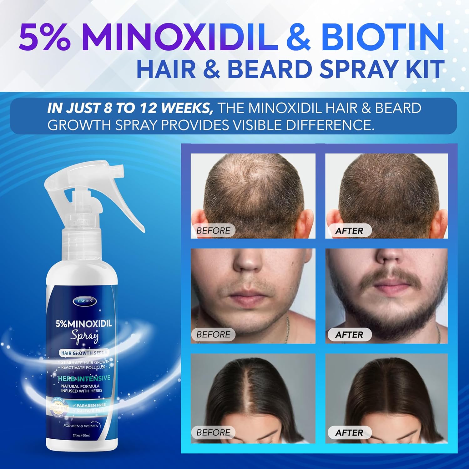 5% Minoxidil Hair Regrowth Spray : Minoxidil for Women Hair Growth Treatment, Minoxidil 5 percent for Men Beard Growth - 60ml - Image 2