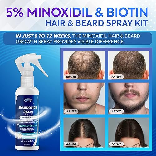 Miniatura 2 de Spray para el crecimiento del cabello con Minoxidil 5%: Tratamiento para el crecimiento del cabello con Minoxidil para mujeres, Minoxidil al 5% para