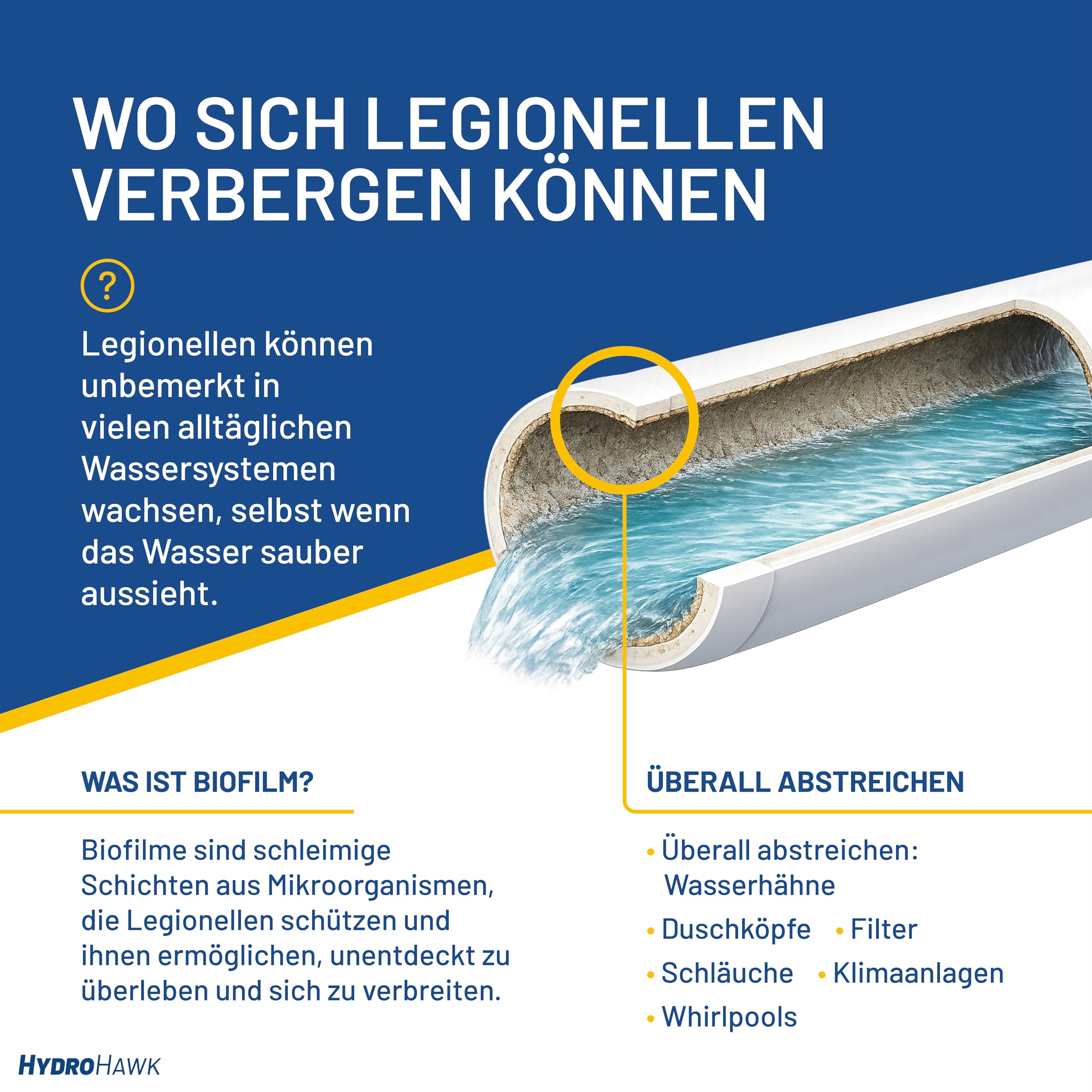 Legionellen-Abstrichtest für Wasserentnahmestellen – 5er-Pack Einweg-Testkits zum Nachweis von Legionella pneumophila sg1 – für Pool, Klimaanlage, Whirlpool – 25-Minuten-Schnelltest