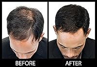 Vista 7 de Fibras capilares voluminizadoras con queratina real para adelgazar el cabello/pérdida de cabello – Dermatológicamente probado y certificado