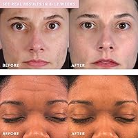 Vista 6 de PMD Personal Microderm Beauty - Set de cuidado de la piel para pieles sensibles, incluye Microderm Pro personal y rubor limpio, máquina