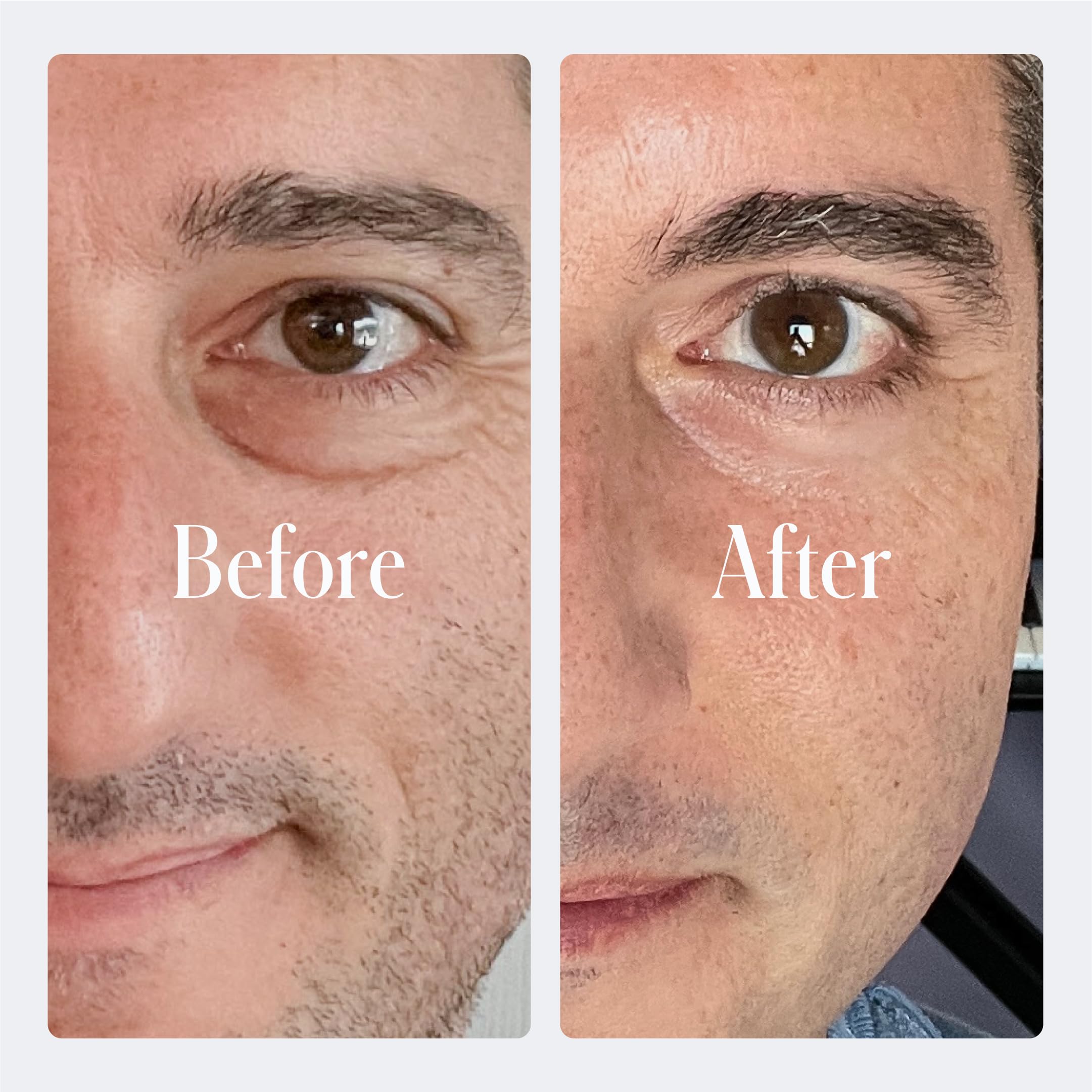 Geologie Dark Circle Under Eye Cream | Treatment For Dark Circles, Puffy Eyes Fine Lines & Wrinkles | Kojic Acid, Caffeine, Peptides, Niacinamide & Hyaluronic Acid | Effective Formula For Men & Women - Image 4