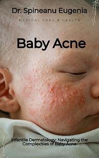 Infantile Dermatology: Navigating the Complexities of Baby Acne (Medical care and health)
