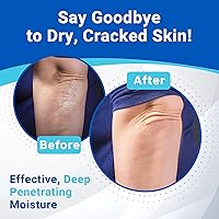 Vista 3 de Dermal Therapy Crema de manos para codos y rodillas con 15% de urea y 6% AHA, hidrata y exfolia profundamente la piel seca y agrietada en manos